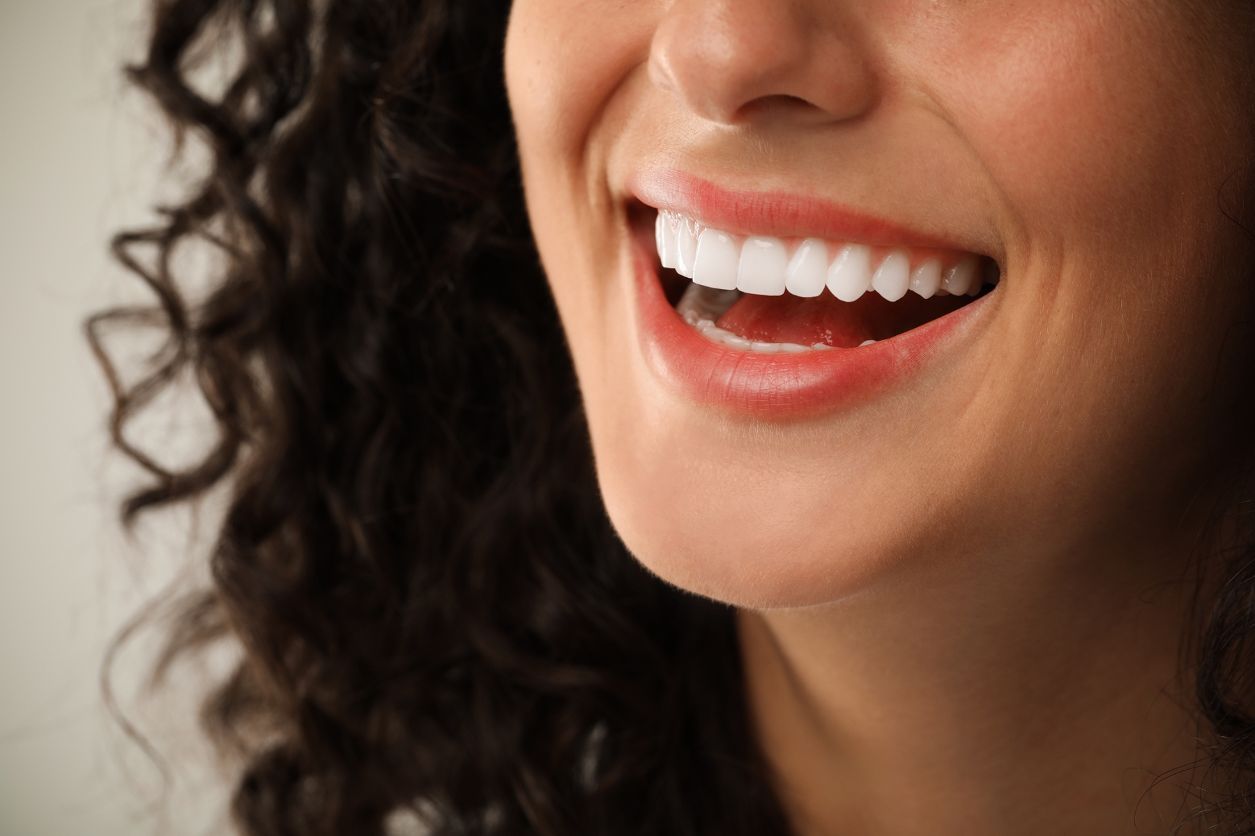 Close-up of a smiling woman showing bright, even teeth, representing porcelain veneers