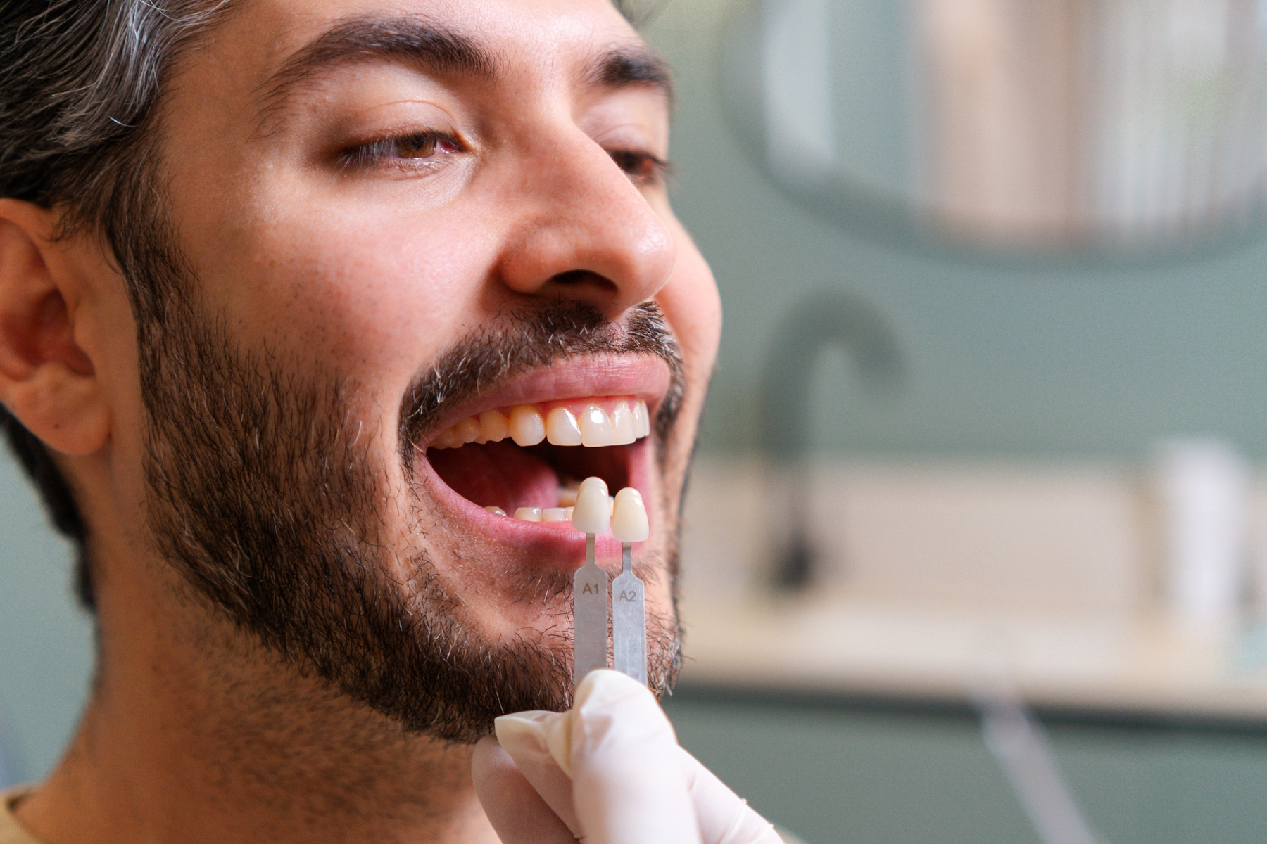 Dentist matching the shade of a dental crown to a patient’s natural teeth