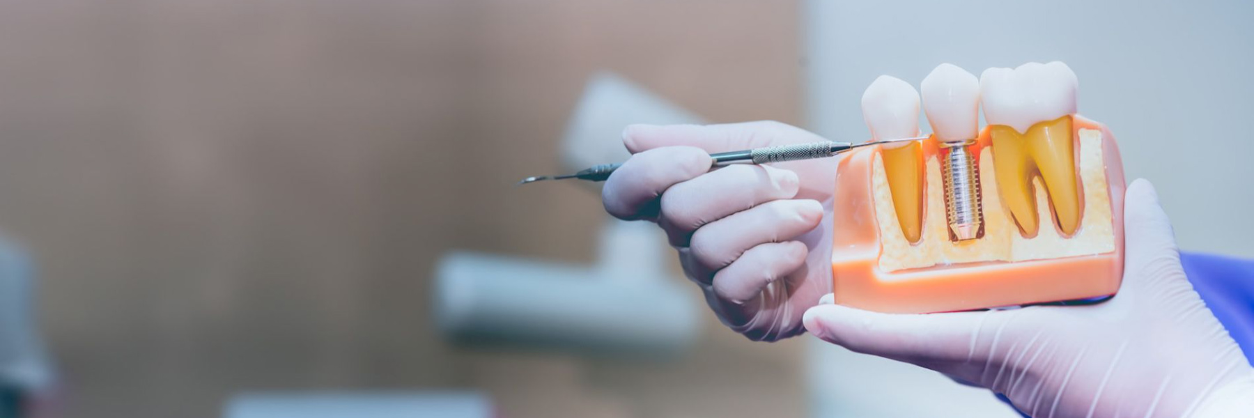 Gloved dentist holding a dental implant model and tool showing implant structure in cross-section