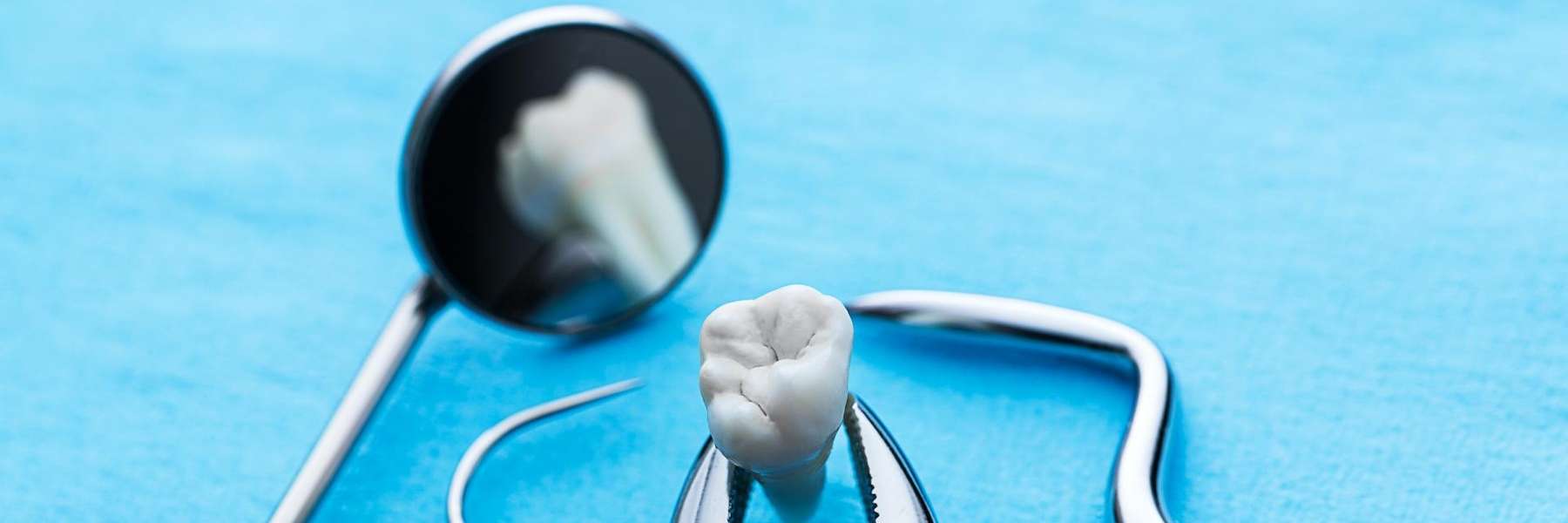 A picture of a tooth taken out from a patient in High Point, NC