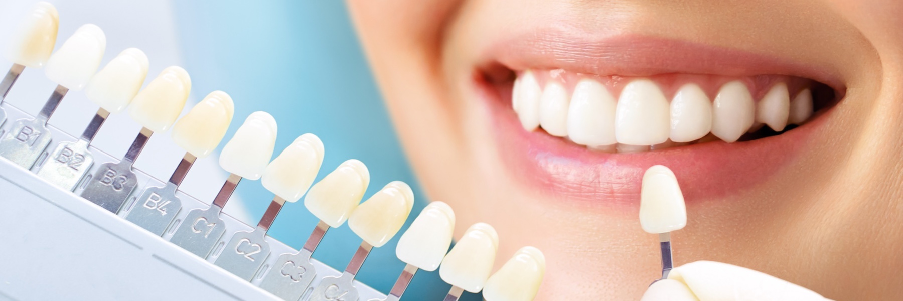 Dentist matching a porcelain crown shade guide to a patient's natural smile