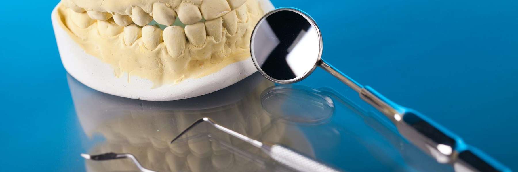 An illustration of a Dental crown in High Point, NC