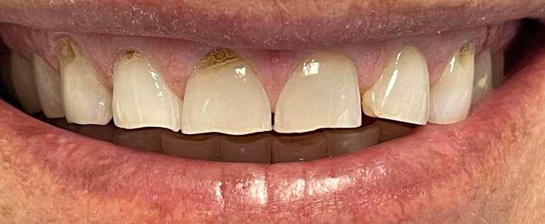 Cosmetic-Dentistry-Before-Image